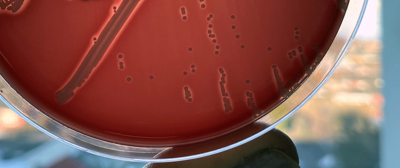 Petriskål med bakteriekolonier