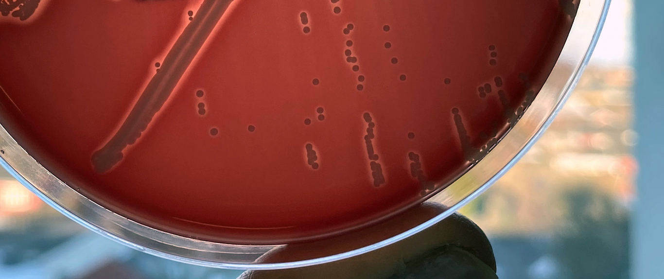 Petri dish with bacteria colonies